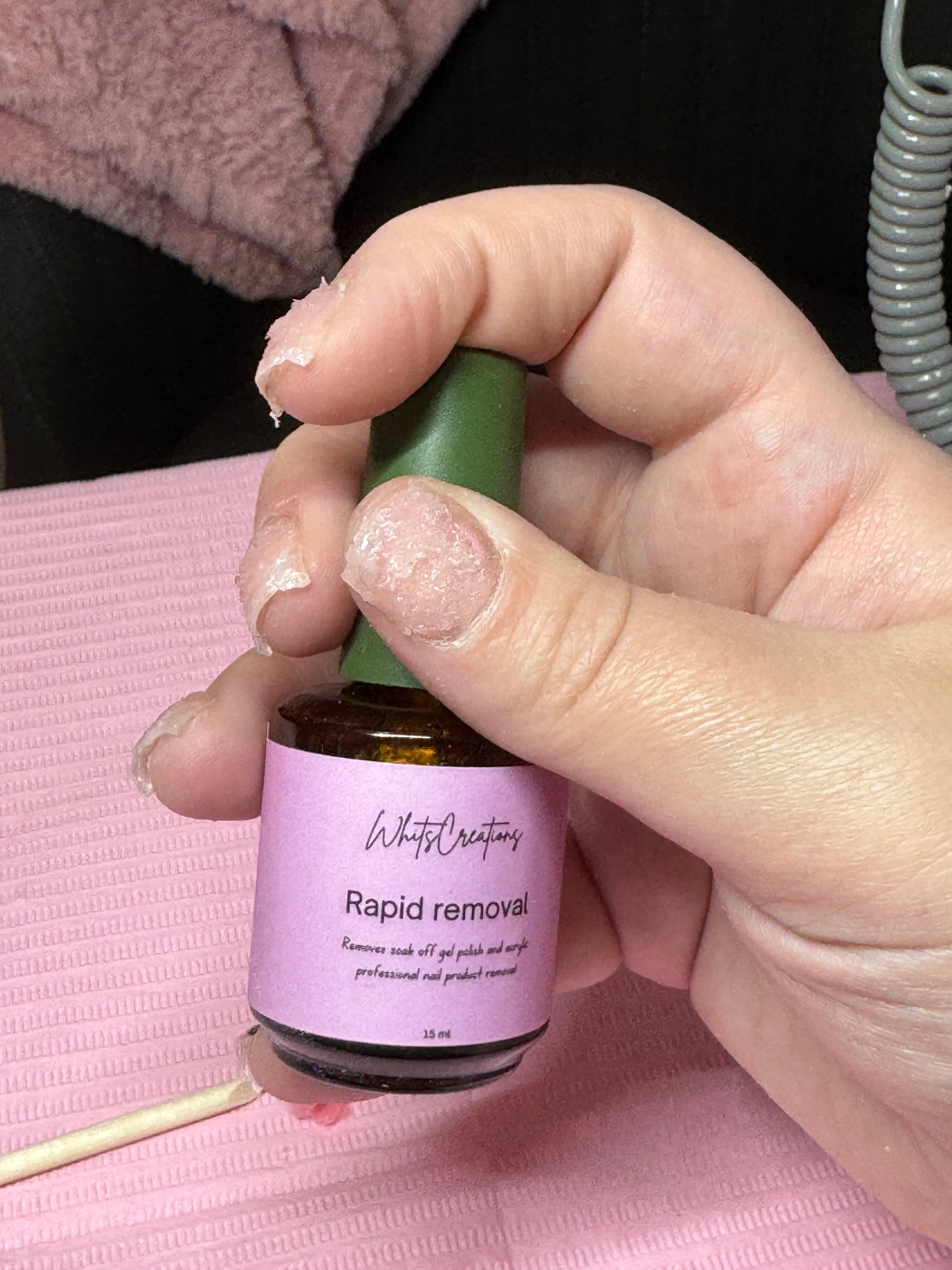 Rapid removal